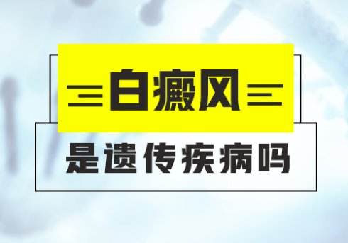 白癜風(fēng)會(huì)不會(huì)遺傳