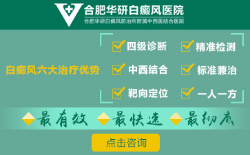 手部的白癜風具體應(yīng)該怎么治療
