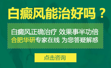 白癜風(fēng)怎么治、如何治療白癜風(fēng)